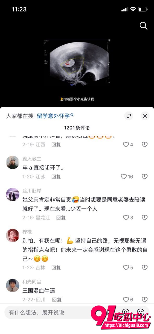 攀小宝3P视频曝光17