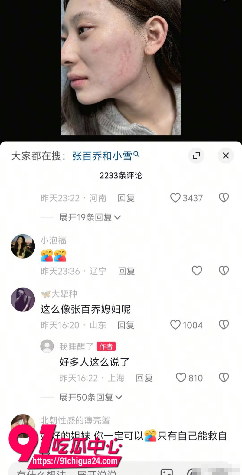 千万大V张百乔家暴老婆视频流出老婆迅速网上辟谣11