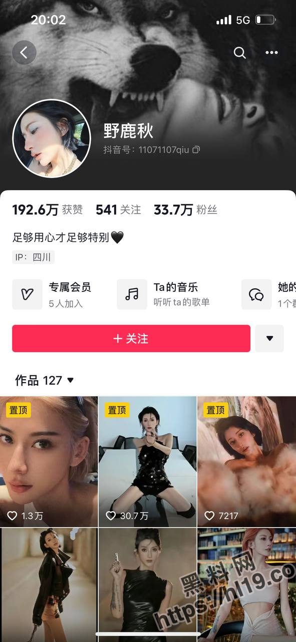 抖音网红「野鹿秋」33W气质博主，直播时却不慎露点被粉丝抓拍，奶头就像一颗小黑豆一样