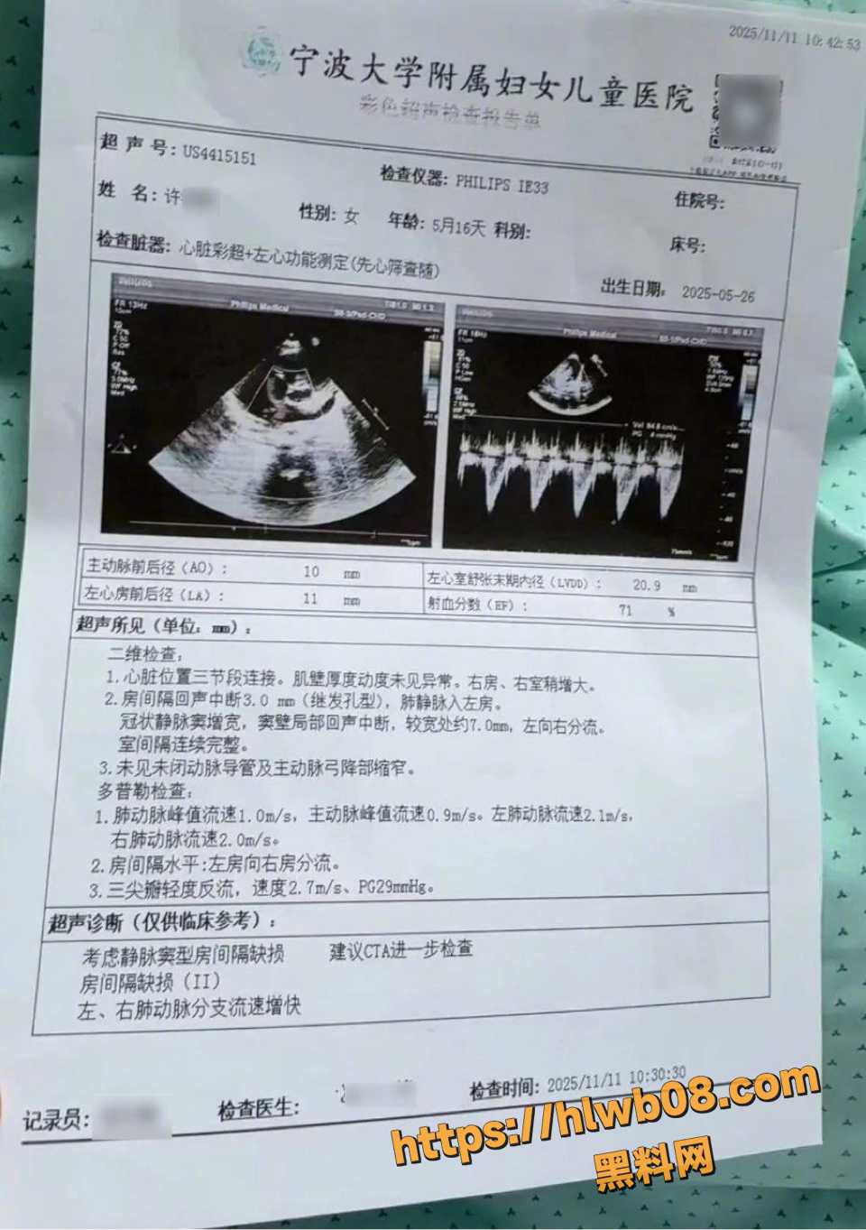 浙江宁波5月龄女婴小洛熙术后离世 宁波妇幼医院疑手术失误 医生停诊卫健委彻查！