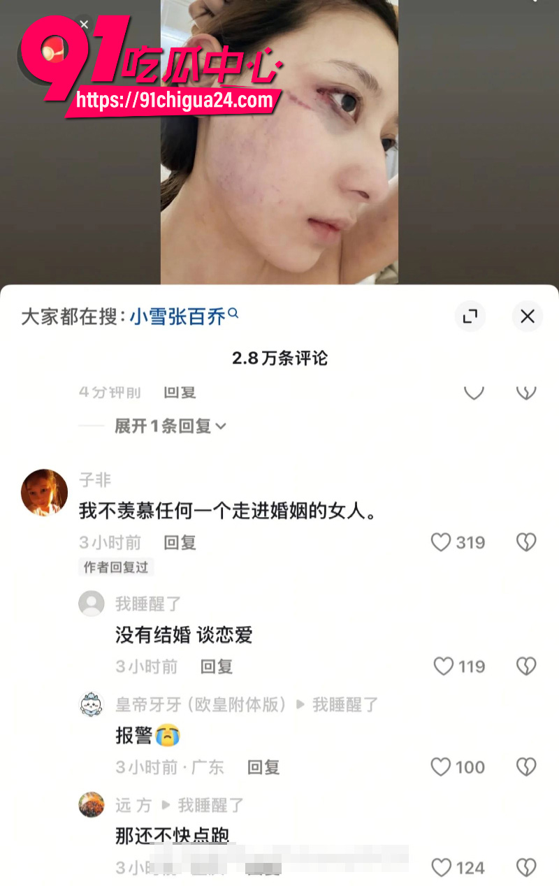 千万大V张百乔家暴老婆视频流出老婆迅速网上辟谣31