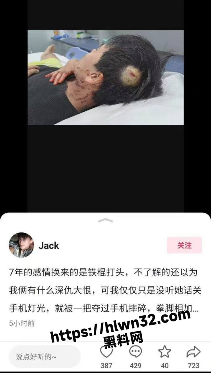 7年的感情换来的是铁棍打头 多名精神小伙围殴男主竟是女主分手后叫人来围殴前任 ！