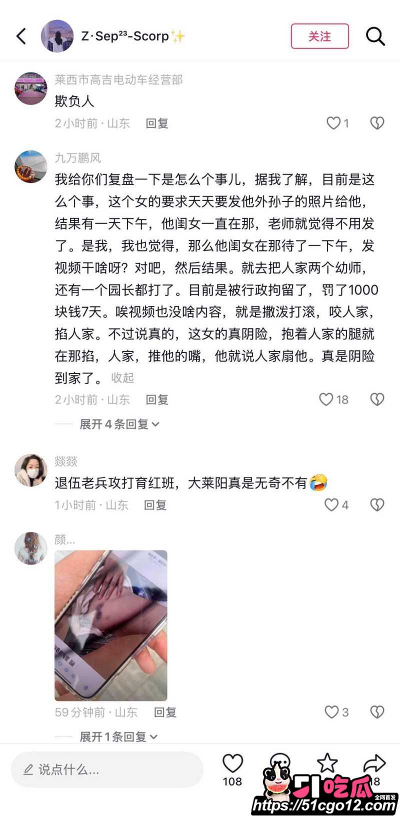 山东烟台莱阳幼儿园打人事件025