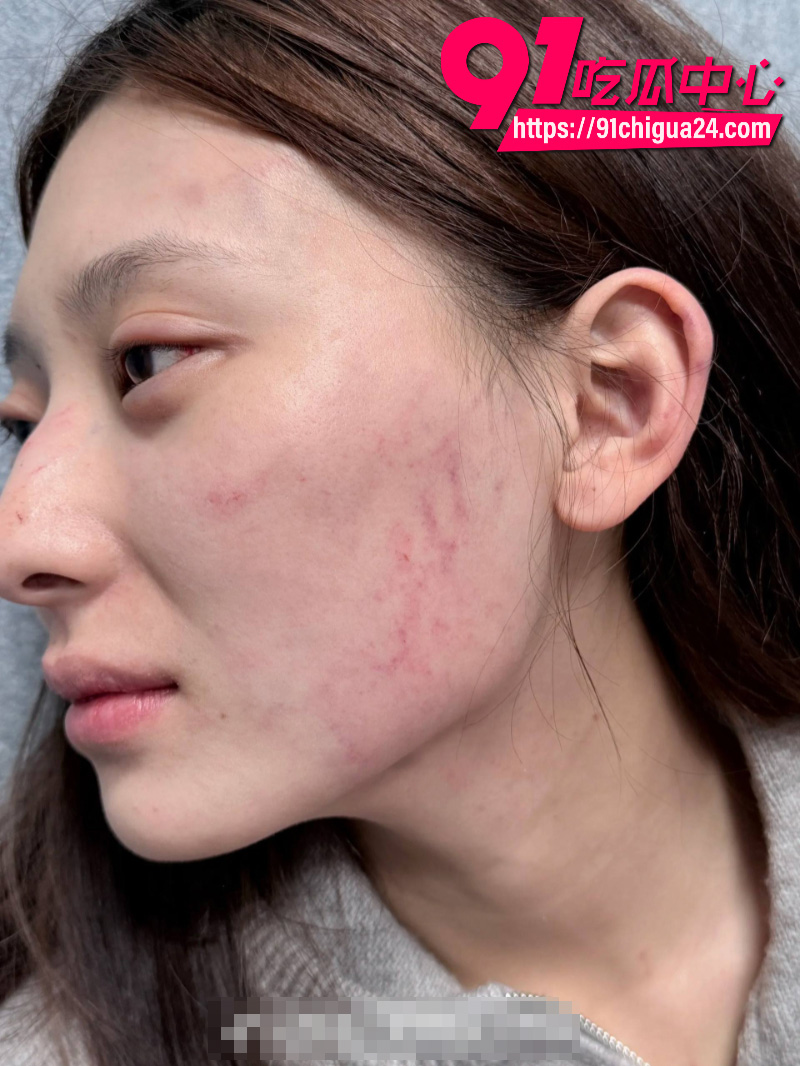 千万大V张百乔家暴老婆视频流出老婆迅速网上辟谣29