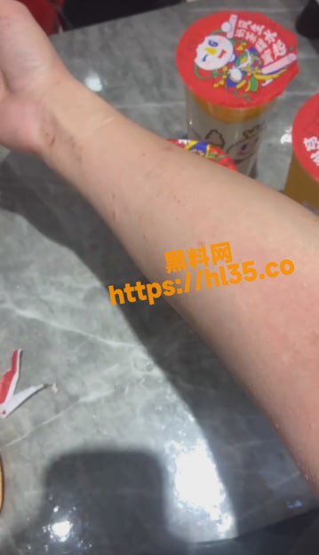 宁波惊现生化母体 在宁波附近的瓜友们注意自身安全