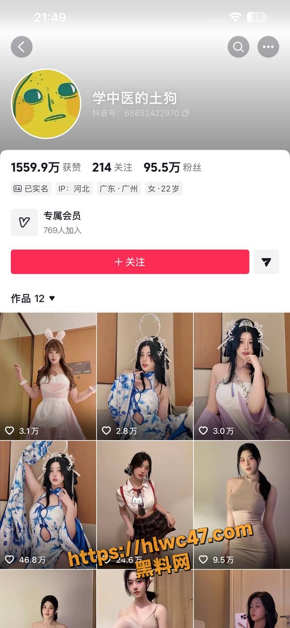 抖音百万粉丝网红 学中医的土狗 付费情趣内衣自拍 反差母狗福利流出
