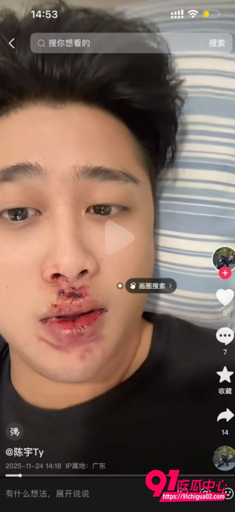 桂山袁聪摔车 估计腰已经断了9