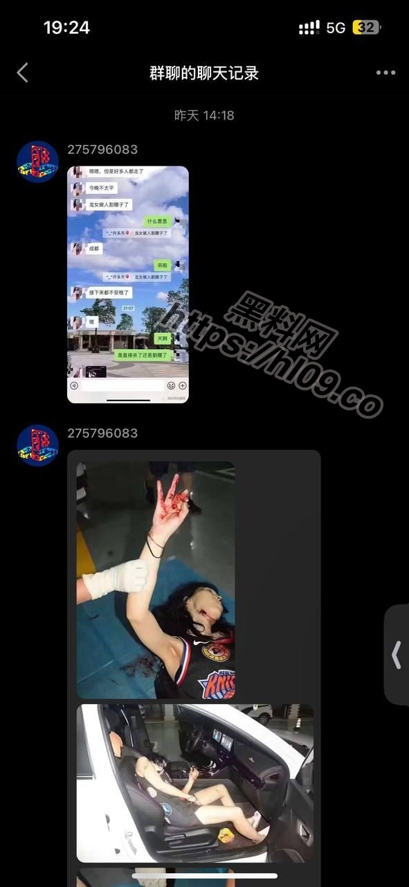网传江苏无锡星梦歌舞厅，龙女出台被人迷晕后惨遭毒手被割腰子，现场画面曝出 配图