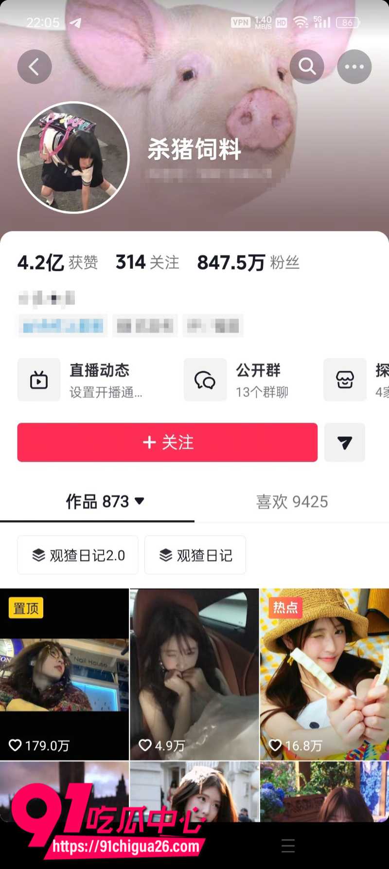 抖音847W粉丝女网红杀猪饲料直播走光7 抖音847W粉丝女网红杀猪饲料直播走光7