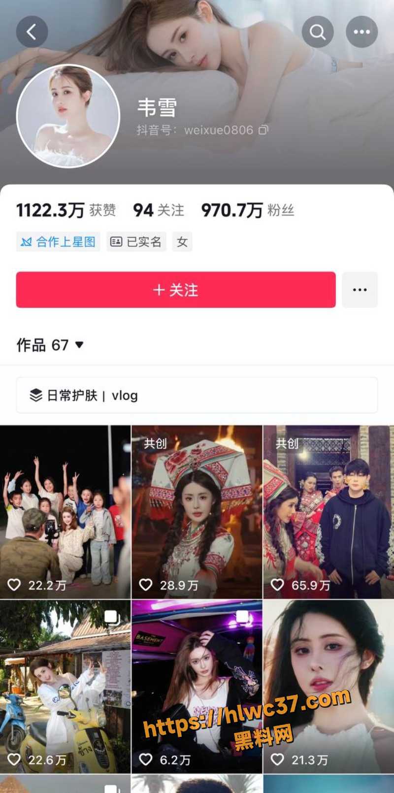 带货女王 韦雪 与 KK分手 真实原因竟是因为太丑 据最新消息前男友整容失败大量问题彻底暴露