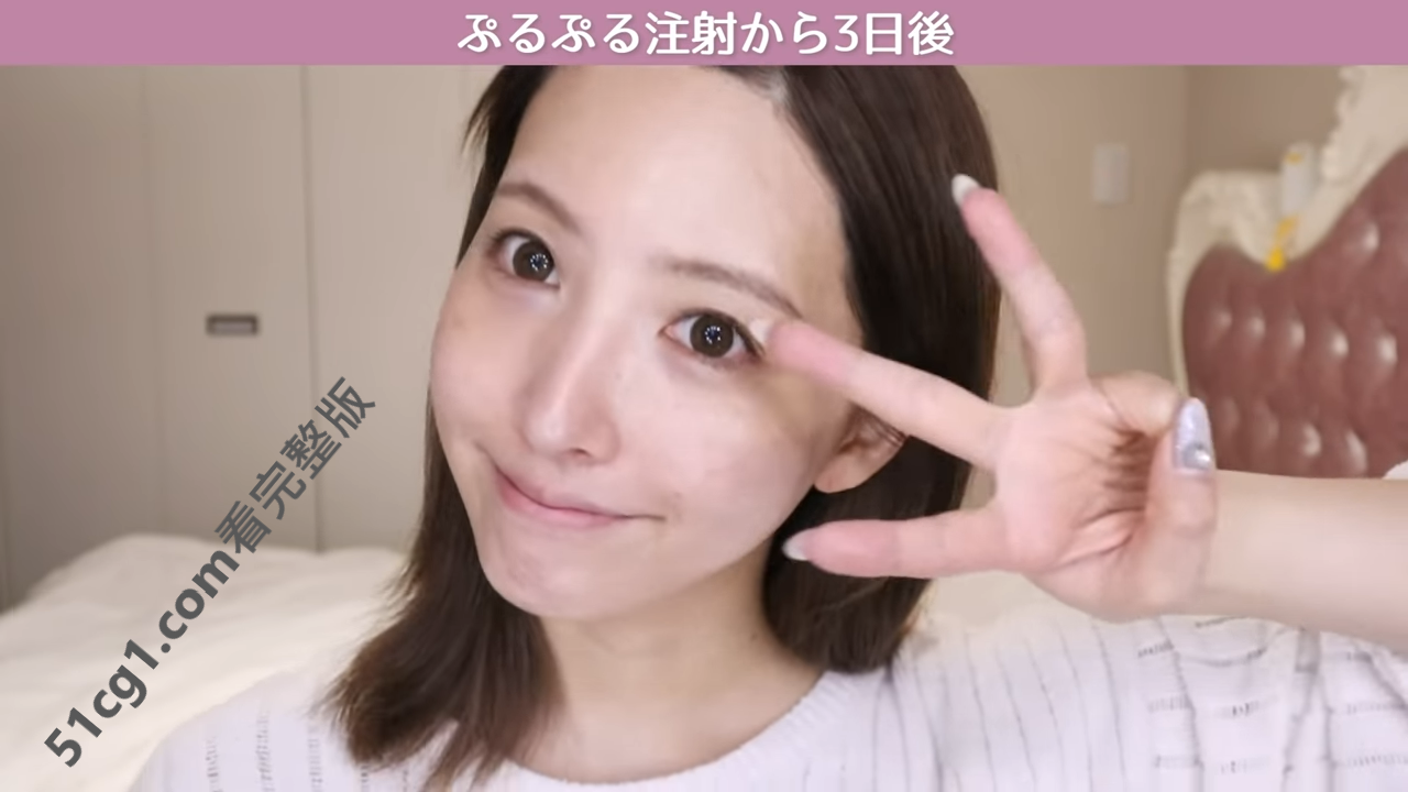 《三上悠亞》首次公開微整過程15