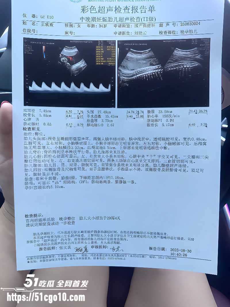河北顺平母狗王欢约炮诬告对方强奸 4