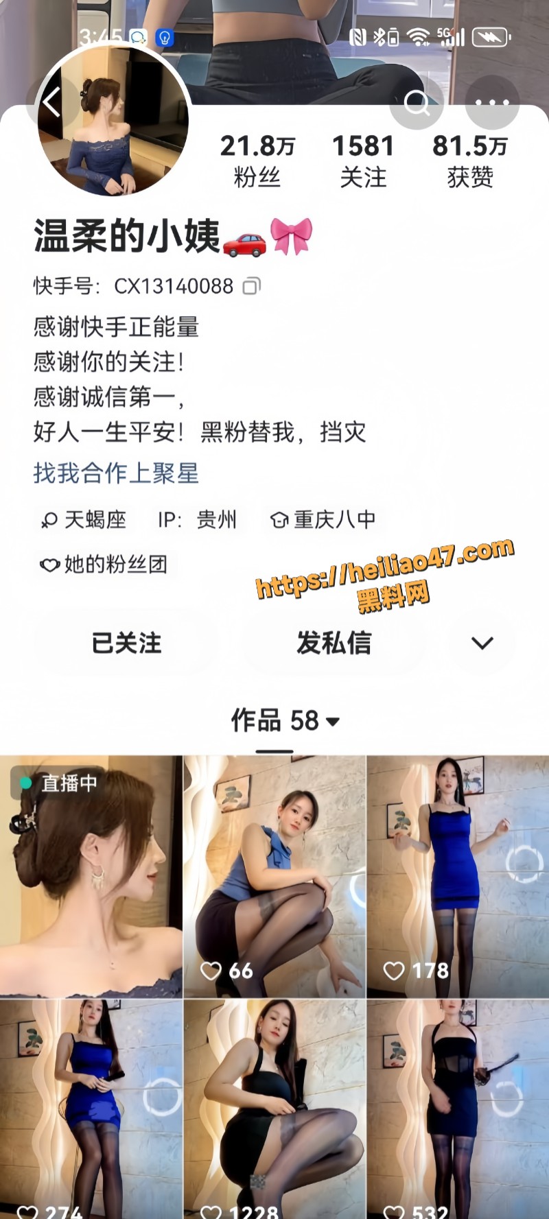 快手颜值靓女 温柔的小姨 大尺度掰逼展示 洞口粉嫩道具自慰 全程挑逗骚到极致！