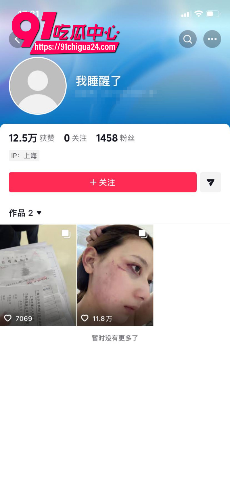 千万大V张百乔家暴老婆视频流出老婆迅速网上辟谣21