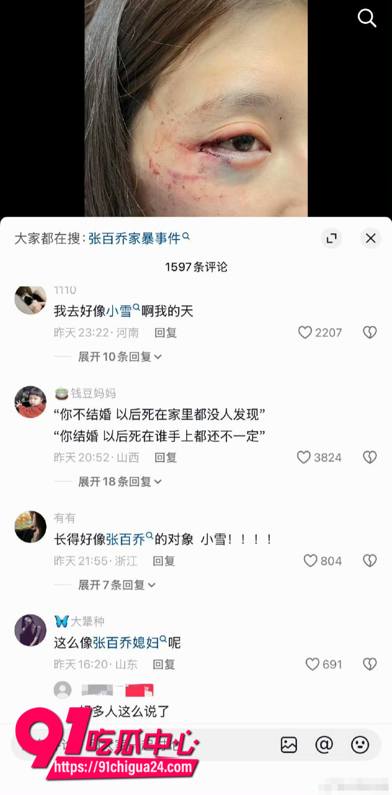 千万大V张百乔家暴老婆视频流出老婆迅速网上辟谣2
